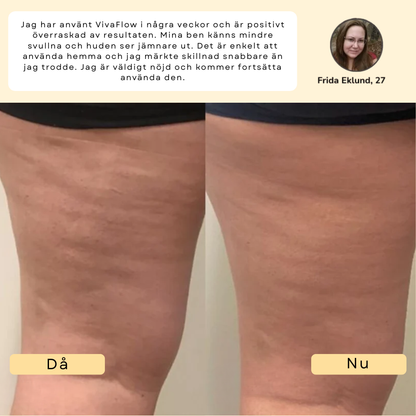 VivaFlow™ – Lymfmassage för en lättare känsla