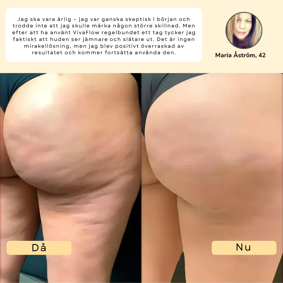 VivaFlow™ – Lymfmassage för en lättare känsla