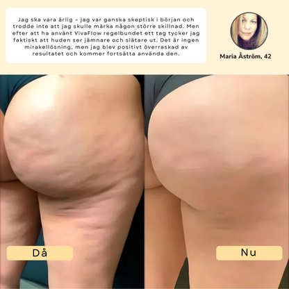 VivaFlow™ – Lymfmassage för en lättare känsla