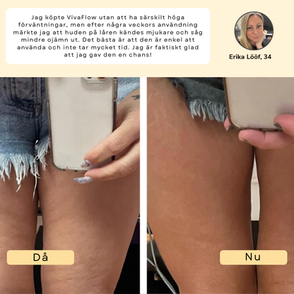 VivaFlow™ – Lymfmassage för en lättare känsla