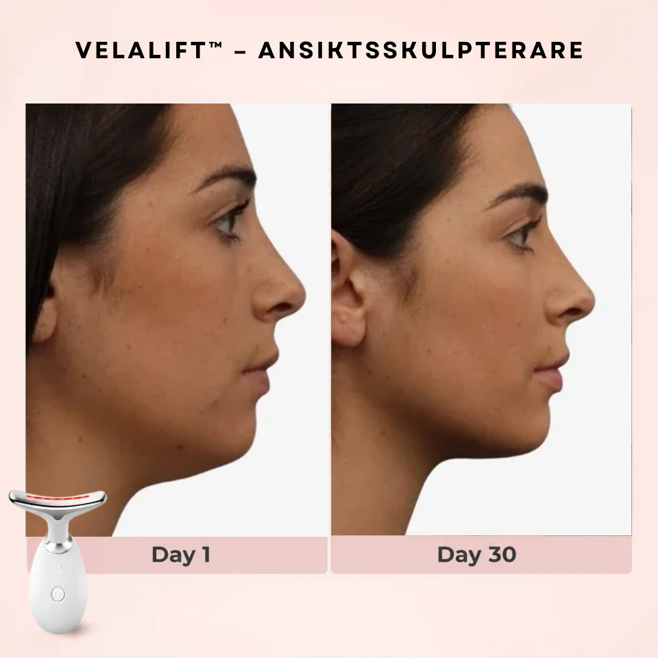 VelaLift™ – Ansiktsskulpterare