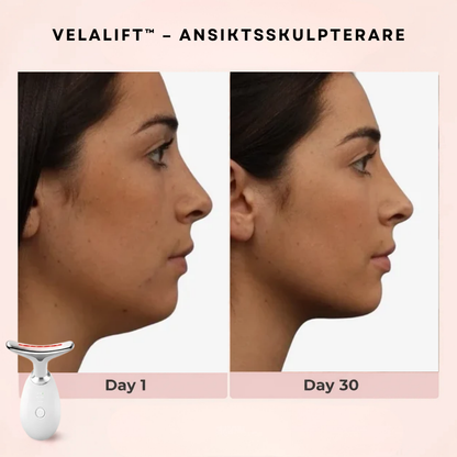 VelaLift™ – Ansiktsskulpterare