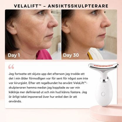 VelaLift™ – Ansiktsskulpterare