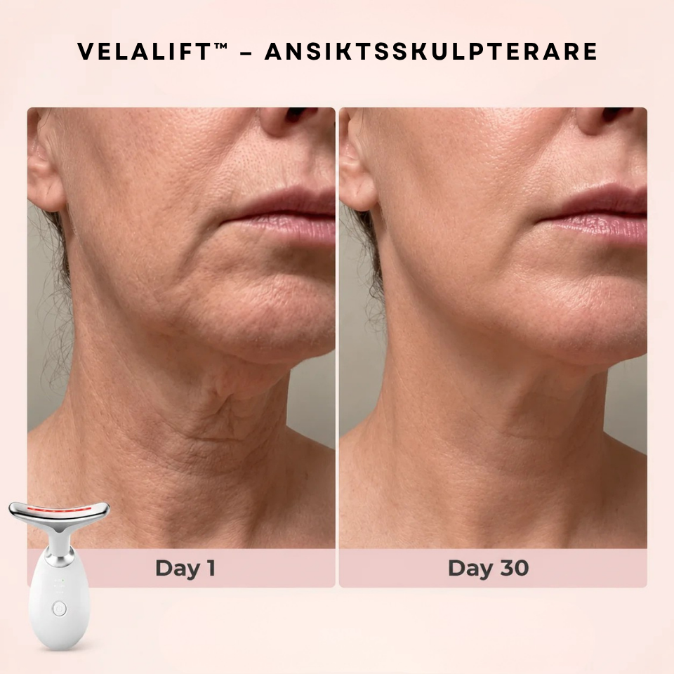 VelaLift™ – Ansiktsskulpterare
