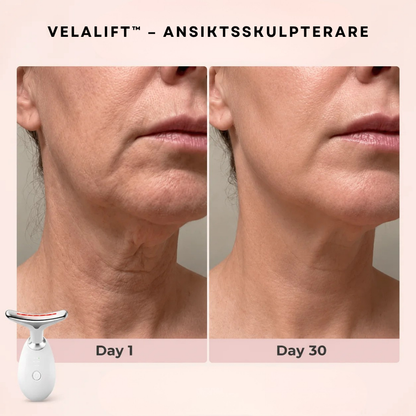 VelaLift™ – Ansiktsskulpterare
